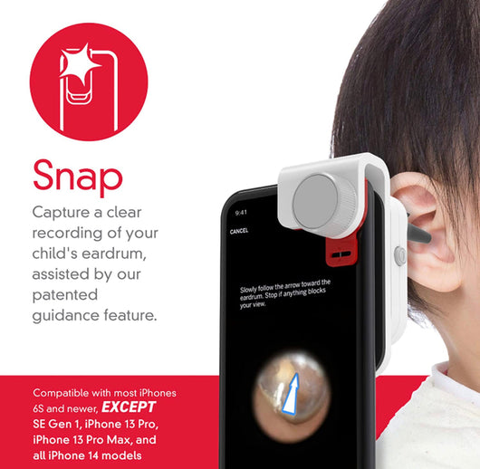 SmartCheck Digital Ear Scope from Children's Tylenol, Otoscope with Light for iPhone, Share Recordings of Your Child’s Eardrum with Your Doctor from Home, 1 Otoscope Clamp, 12 Specula Tips- NEW IN BOX!!!!